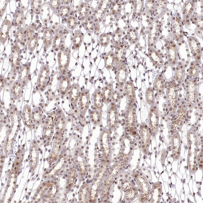 APC6 Recombinant Rabbit mAb (S-2550-48)
