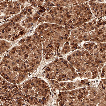SBDS Recombinant Rabbit mAb (S-R344)