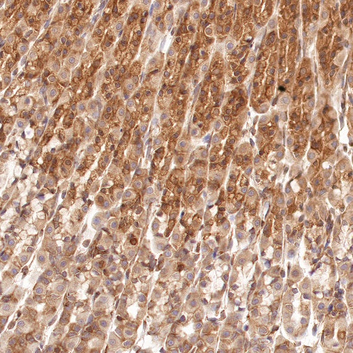 Argonaute-2 Recombinant Rabbit mAb (S-1826-47)