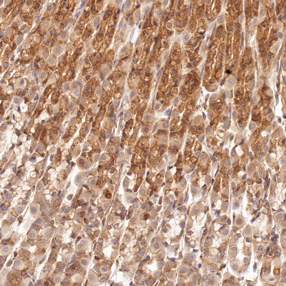Argonaute-2 Recombinant Rabbit mAb (S-1826-47)