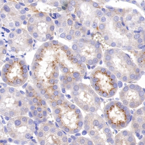 IFIT1 Recombinant Rabbit mAb (S-962-58)
