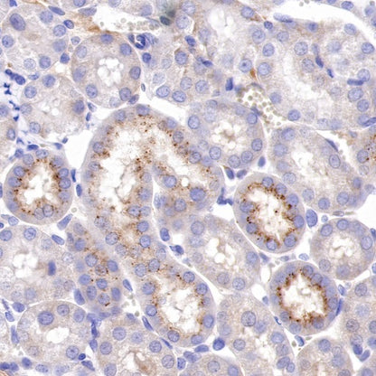 IFIT1 Recombinant Rabbit mAb (S-962-58)