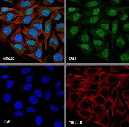 GRB2 Recombinant Rabbit mAb (S-5948)