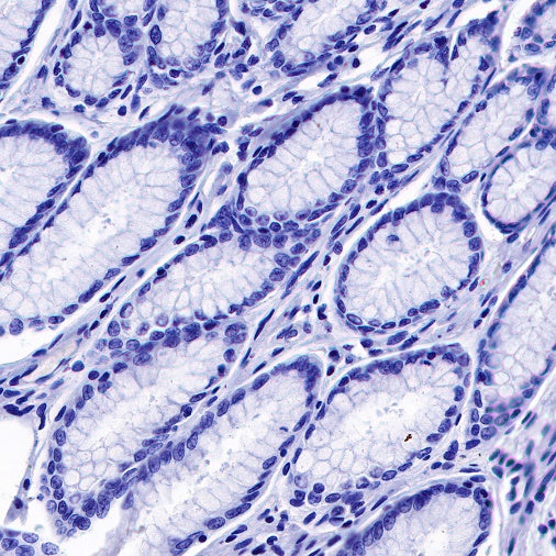 S-RMab® Helicobacter pylori Recombinant Rabbit mAb (SDT-R273)