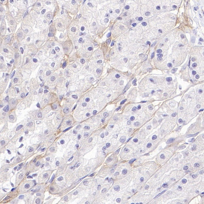 Versican Recombinant Rabbit mAb (S-3770-43)