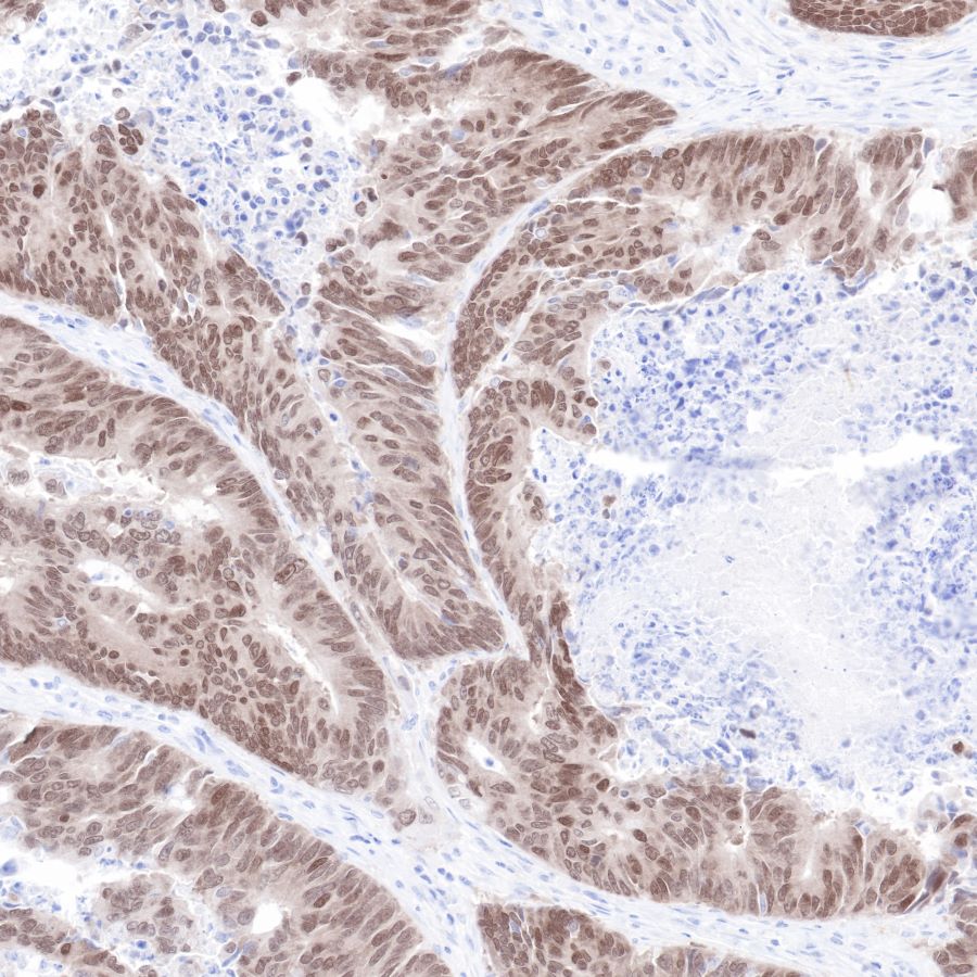 CDX2 Recombinant Rabbit mAb (SDT-134-76)