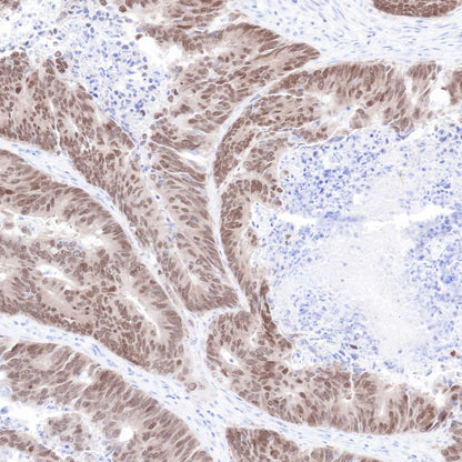 CDX2 Recombinant Rabbit mAb (SDT-134-76)