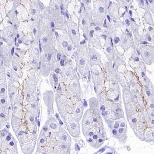 Occludin Recombinant Rabbit mAb (SDT-4588)