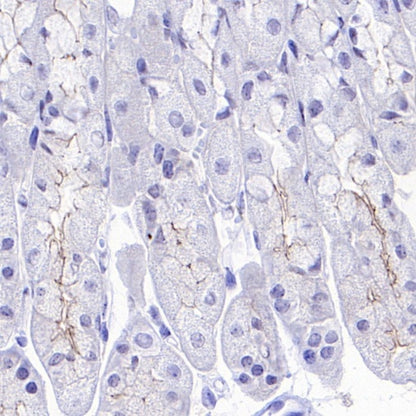 Occludin Recombinant Rabbit mAb (SDT-4588)