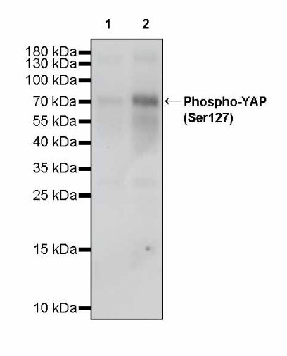 Phospho-YAP (Ser127) Recombinant Rabbit mAb (S-4250)