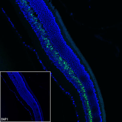 CHX10 Recombinant Rabbit mAb (S-3940-13)