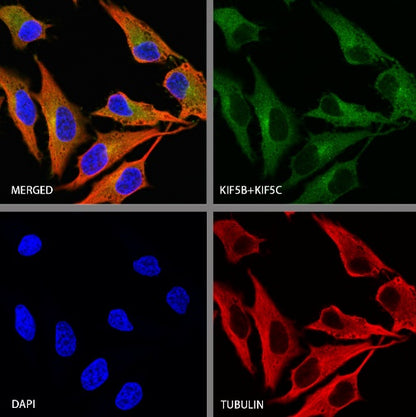 KIF5B+KIF5C Recombinant Rabbit mAb (S-2452-15)