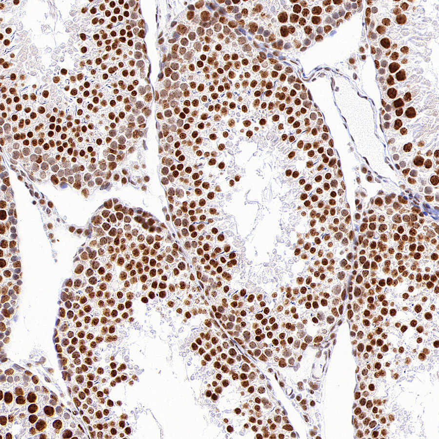 PABPN1 Rabbit Polyclonal Antibody