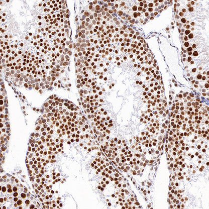 PABPN1 Rabbit Polyclonal Antibody