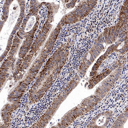 CHMP1a Recombinant Rabbit mAb (S-1651-159)