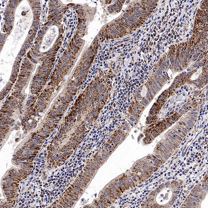 CHMP1a Recombinant Rabbit mAb (S-1651-159)