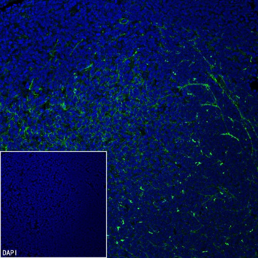 CXCL13 Recombinant Rabbit mAb (SDT-2703-132)