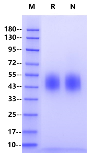 Fc epsilon RI α His Tag Protein, Human