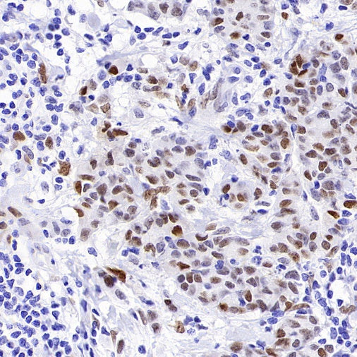 ATF3 Recombinant Rabbit mAb (SDT-4100)