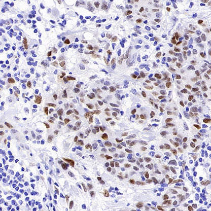 ATF3 Recombinant Rabbit mAb (SDT-4100)