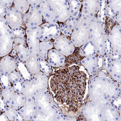 Galectin-1/LGALS1 Rabbit Polyclonal Antibody