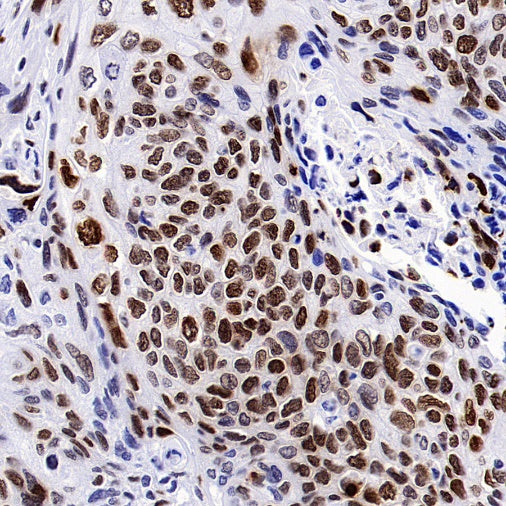 Phospho-Histone H2A.X (Ser139) Recombinant Rabbit mAb (S-1368-15)