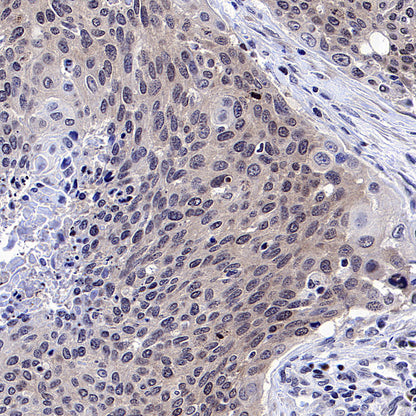 CDK4 Rabbit Polyclonal Antibody