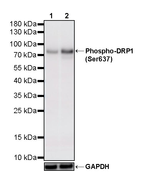 Phospho-DRP1 (Ser637) Recombinant Rabbit mAb (S-5676)