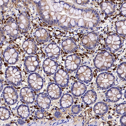 Human IgA1 Rabbit Polyclonal Antibody