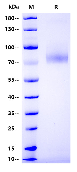 Nipah Virus Glycoprotein G Protein, His Tag