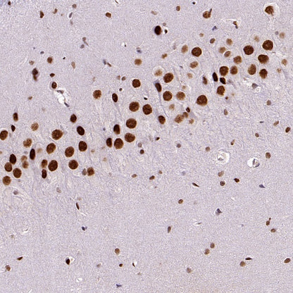 TCF-4 Recombinant Rabbit mAb,PBS Only (SDT-2549-4)