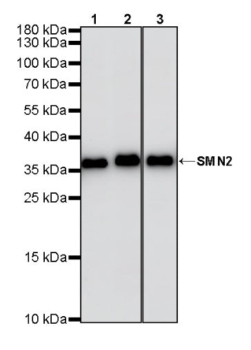 SMN2 Recombinant Rabbit mAb (S-4920-4)