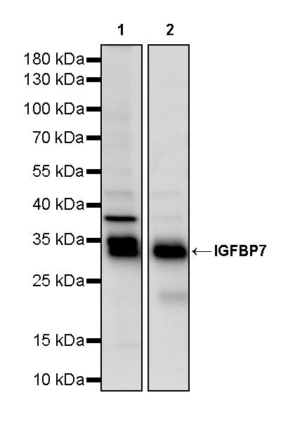 IGFBP7 Recombinant Rabbit mAb (S-3091-44)