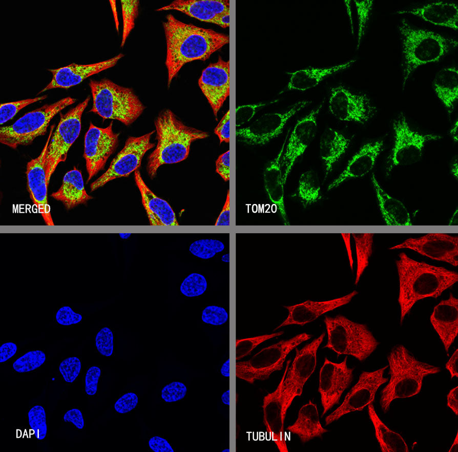 TOM20 Recombinant Rabbit mAb (S-M0015)