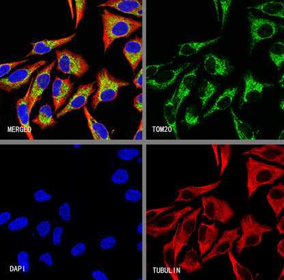 TOM20 Recombinant Rabbit mAb (S-M0015)