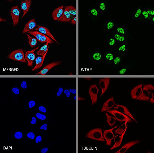 WTAP Recombinant Rabbit mAb (S-2741-49)