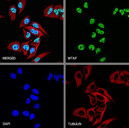 WTAP Recombinant Rabbit mAb (S-2741-49)