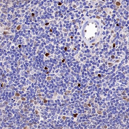 TCF-4 Recombinant Rabbit mAb,PBS Only (SDT-2549-4)
