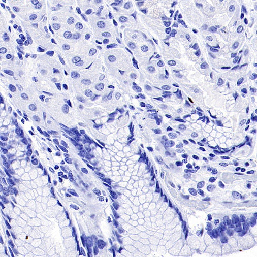 CEACAM6 Recombinant Rabbit mAb (S-720-54)