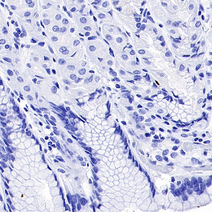 CEACAM6 Recombinant Rabbit mAb (S-720-54)