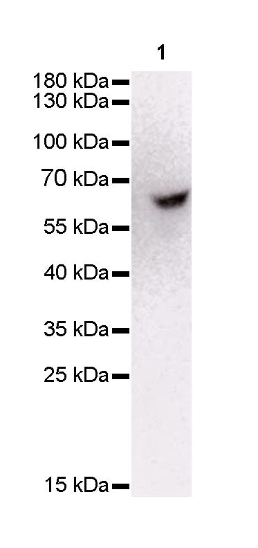 keratin 6 Rabbit mAb (SDT-015-69)