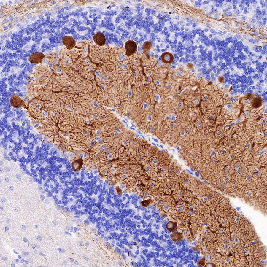 ITPR1 Recombinant Rabbit mAb (S-4530-5)