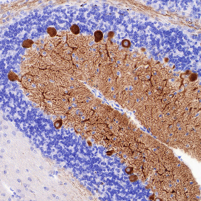 ITPR1 Recombinant Rabbit mAb (S-4530-5)