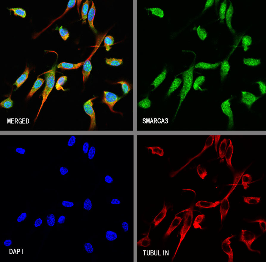 SMARCA3 Recombinant Rabbit mAb (S-3575-154)