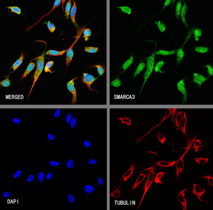 SMARCA3 Recombinant Rabbit mAb (S-3575-154)