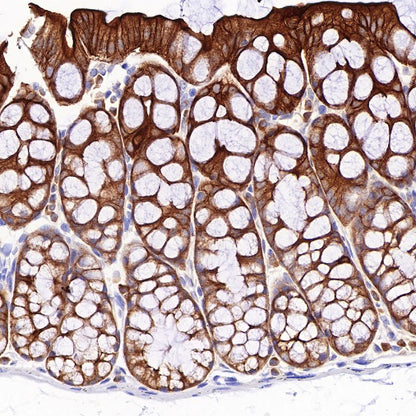 Villin Recombinant Rabbit mAb (SDT-R255)