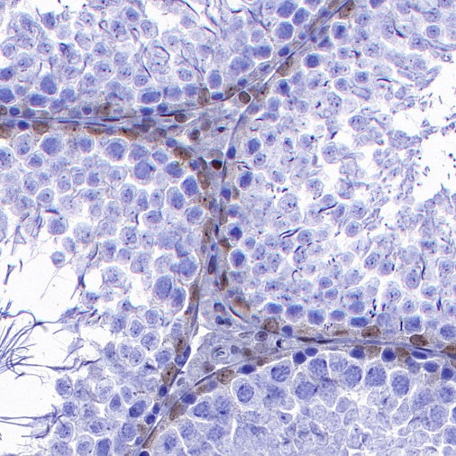 p27 Recombinant Rabbit mAb (S-141-135)
