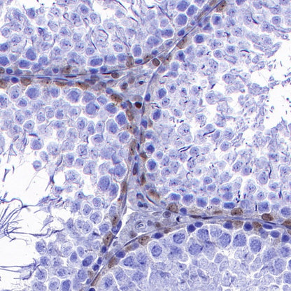 p27 Recombinant Rabbit mAb (S-141-135)