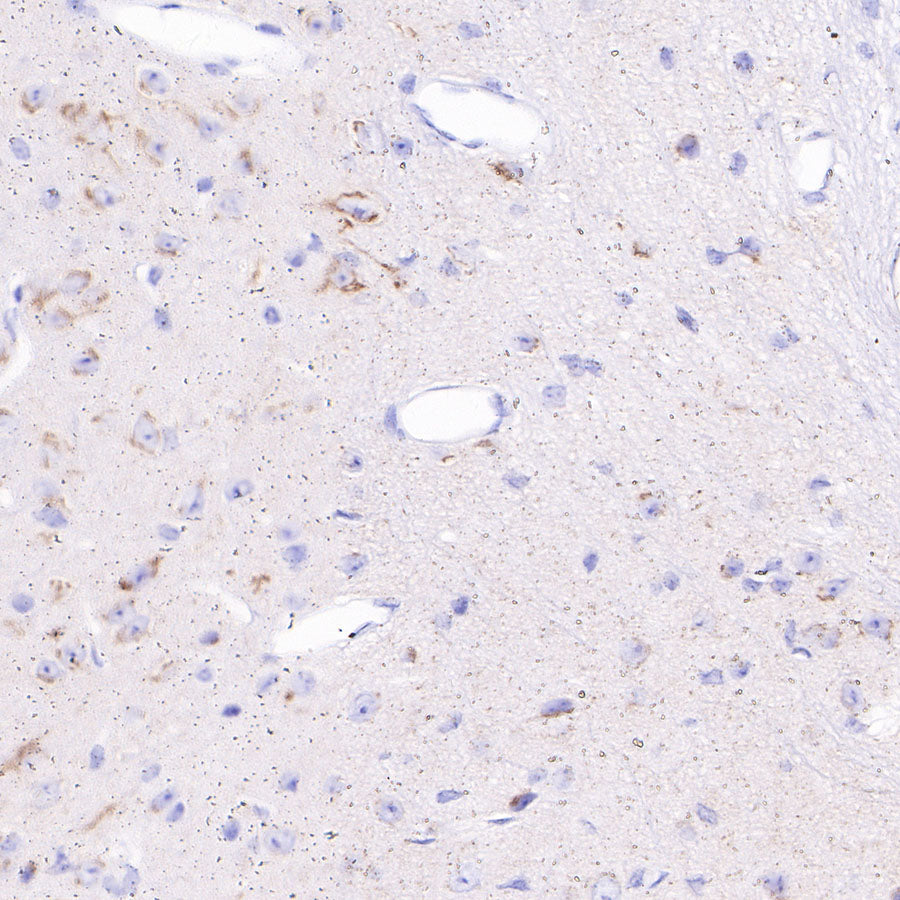 S-RMab® Chromogranin A Recombinant Rabbit mAb (SDT-074-57)
