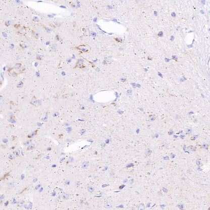S-RMab® Chromogranin A Recombinant Rabbit mAb (SDT-074-57)